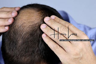 Hair loss, known medically as alopecia is a concern impacting millions of individuals globally.