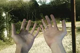 Distorted image of 2 hands with trees in the background. Distortion in tunnel vision, contrast and colors reflects the experience of DPDR.